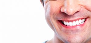 Full mouth dental implants in Sydney